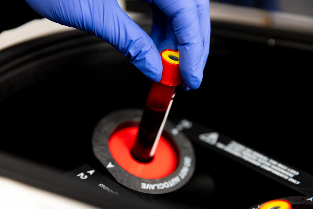 A nurse wearing blue gloves prepares a sample for BHRT in Winston-Salem