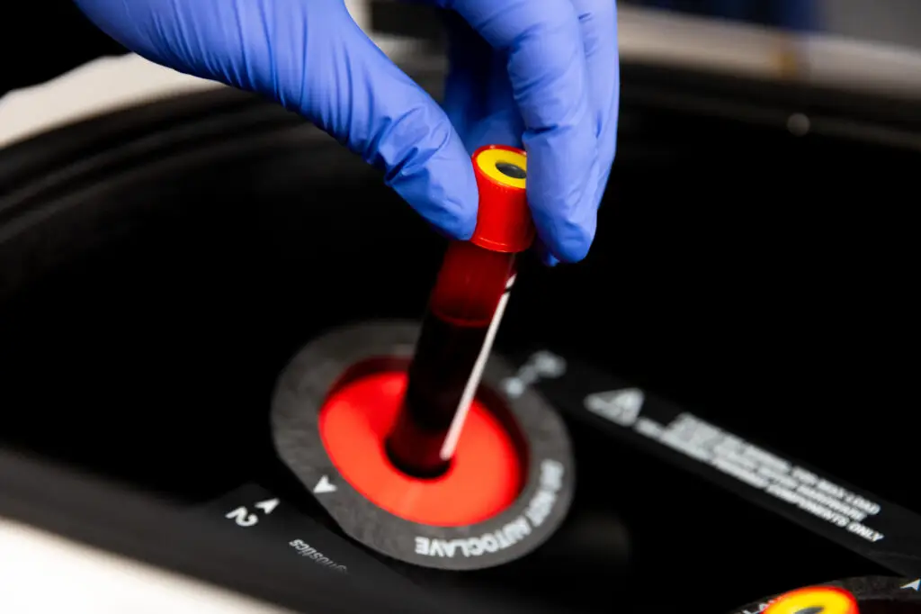 A Restoration MedSpa provider wearing blue gloves prepares a vial of a patient's drawn blood to be sent to the lab. This will help the provider determine the patient's eligibility for vaginal injections in Greensboro.