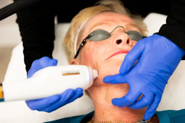 Close-up of a provider with blue gloves performing laser skin resurfacing in Greensboro on a female patient's face