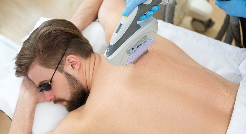 |Beautician giving men laser epilation