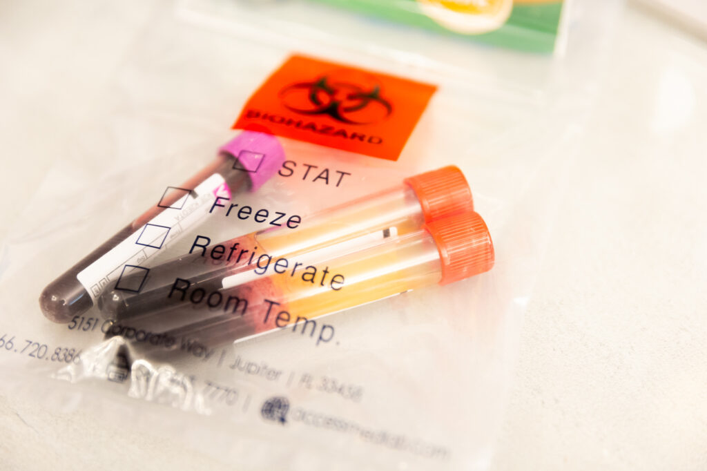 Three vials of a patient's drawn blood sit in a sterilized bag waiting to go to the labs for analyzation. This helps us understand current hormone levels so that we can accurately prescribe the correct dosages in their HRT pellets in Winston-Salem.
